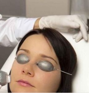 Laser rejuvenation field