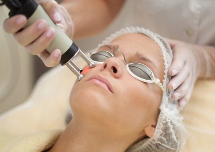 Field rejuvenation procedure
