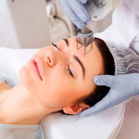 Photothermolysis procedure to rejuvenate facial skin