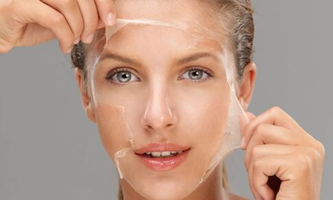 Deep peeling strengthens the regeneration processes in the skin, rejuvenating it